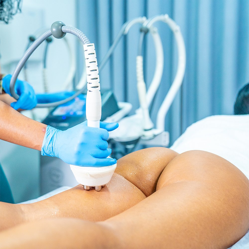 Radiofrequência Tripular com Estimulação Muscular