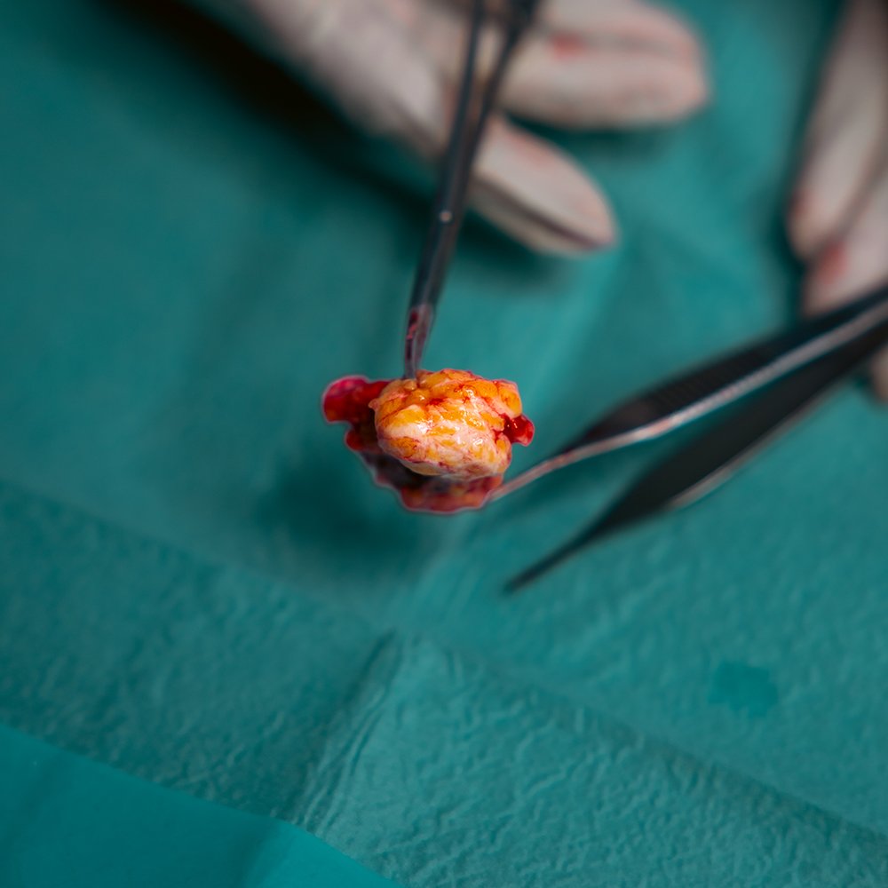 Cirurgia Geral / Oncologia - imagem 1