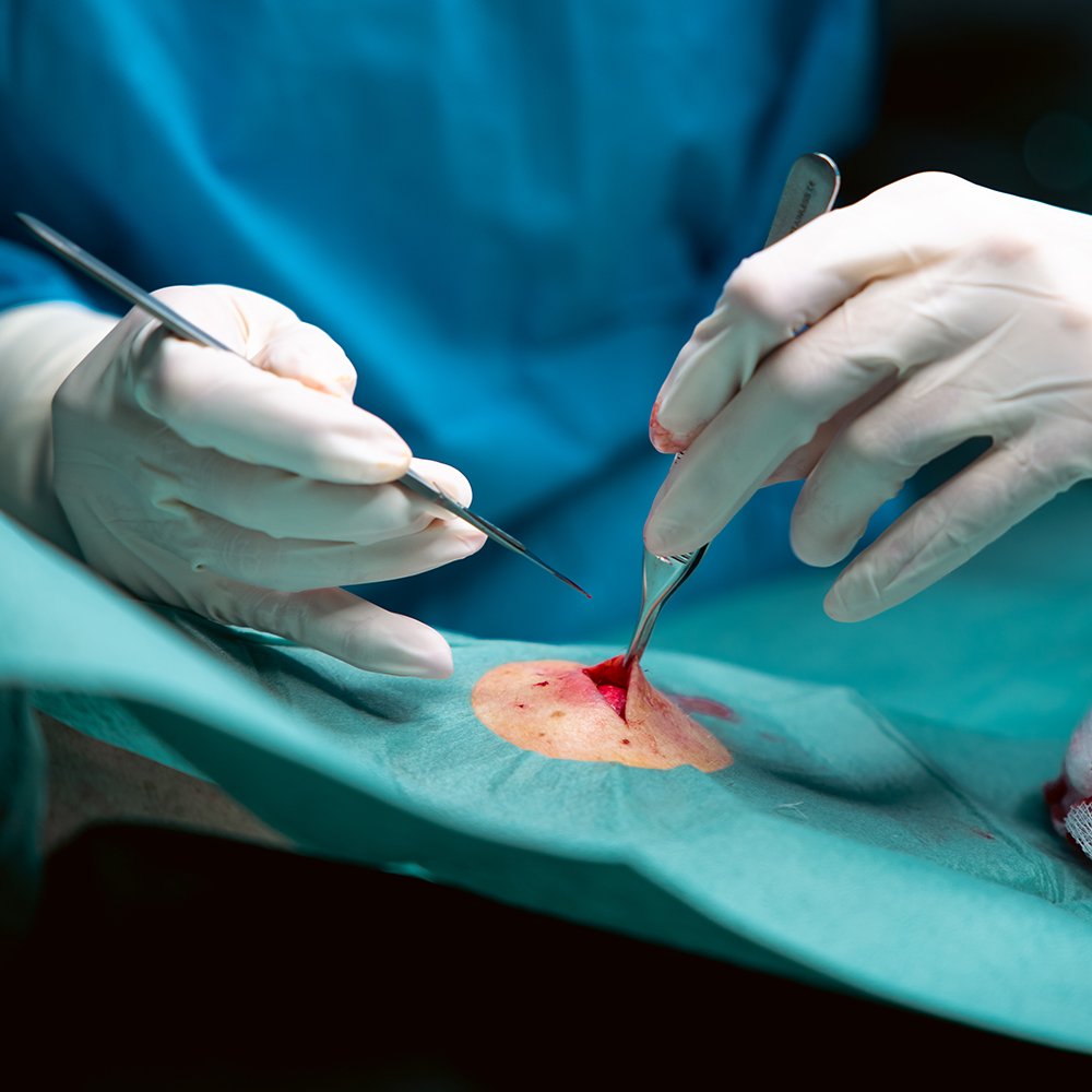 Cirurgia Geral / Oncologia - imagem 3