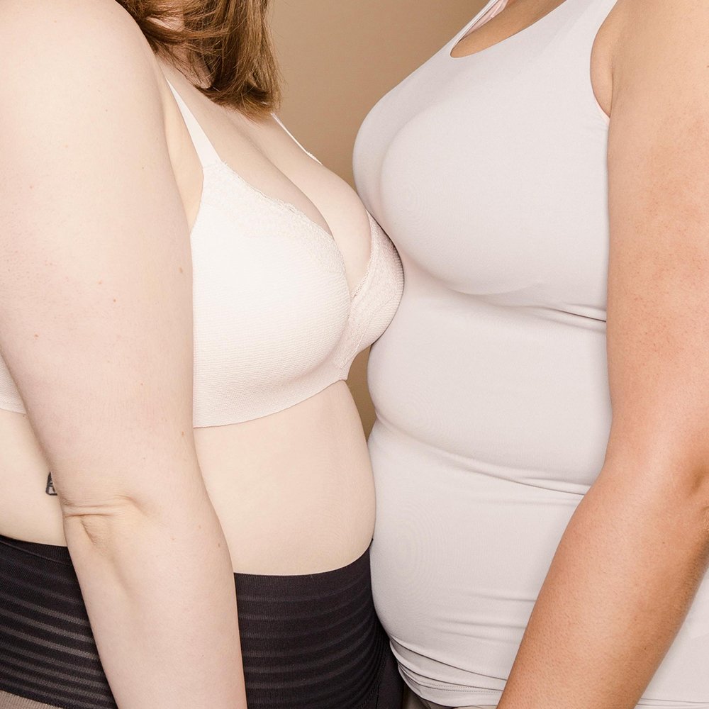Abdominoplastia